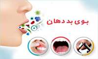 بوی بد دهان